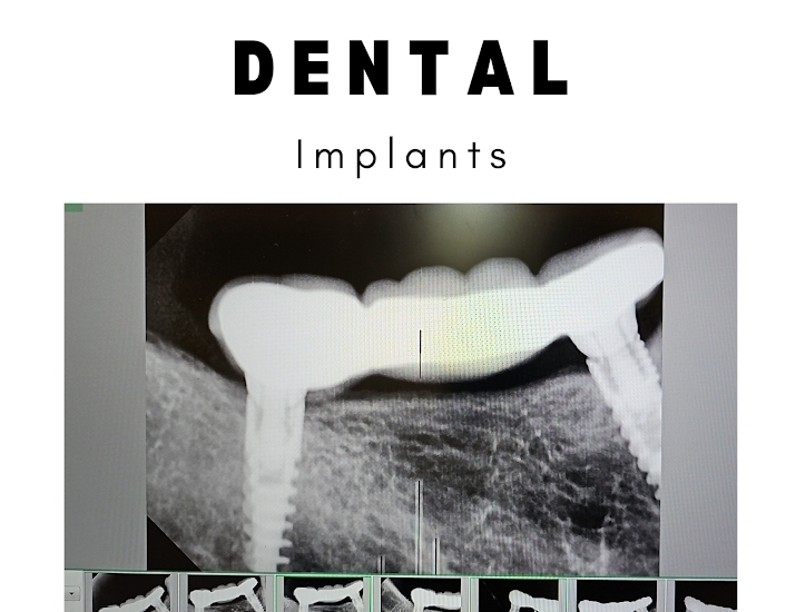 Dental Equipment