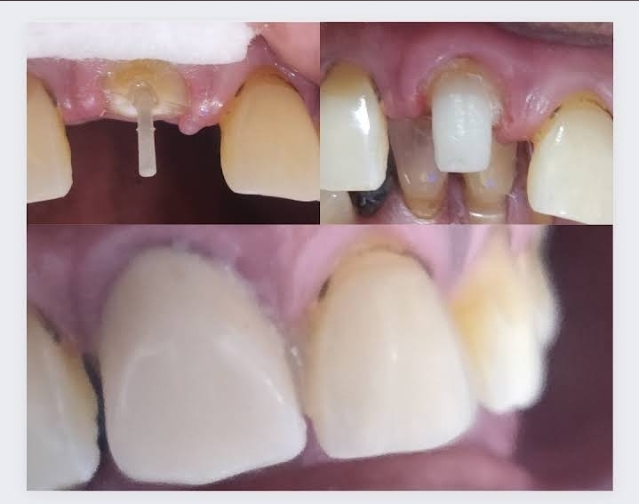 Patient Smile Transformation
